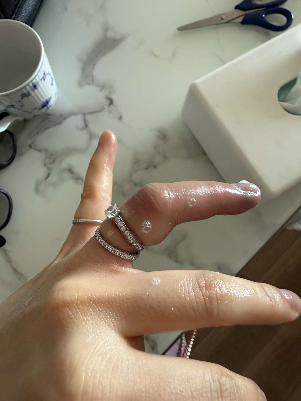 レス1番の画像2