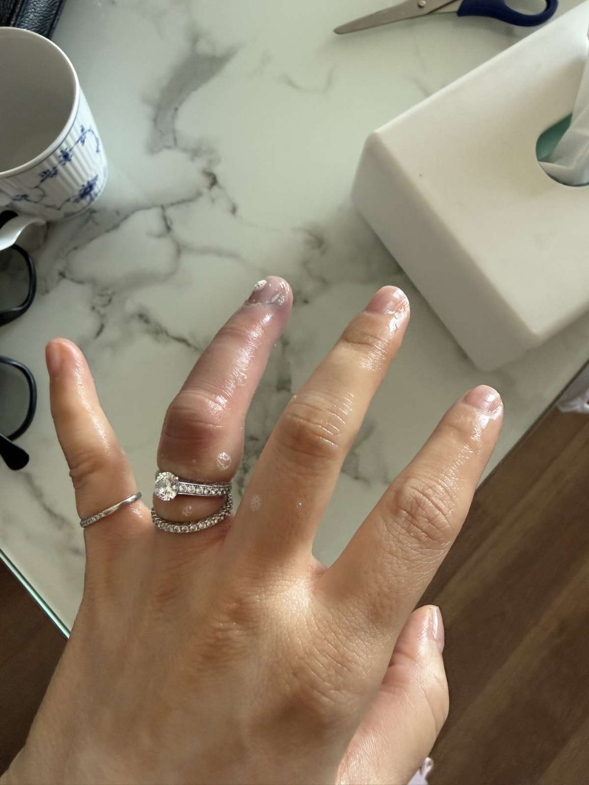 レス1番の画像5