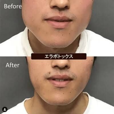 レス2番の画像3